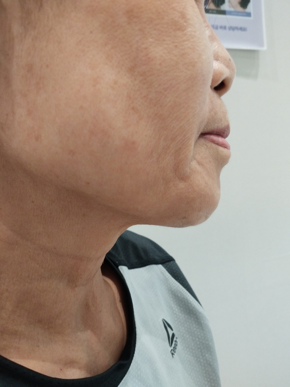 Liting Plastic Surgery Clinic Busan Branch clinic