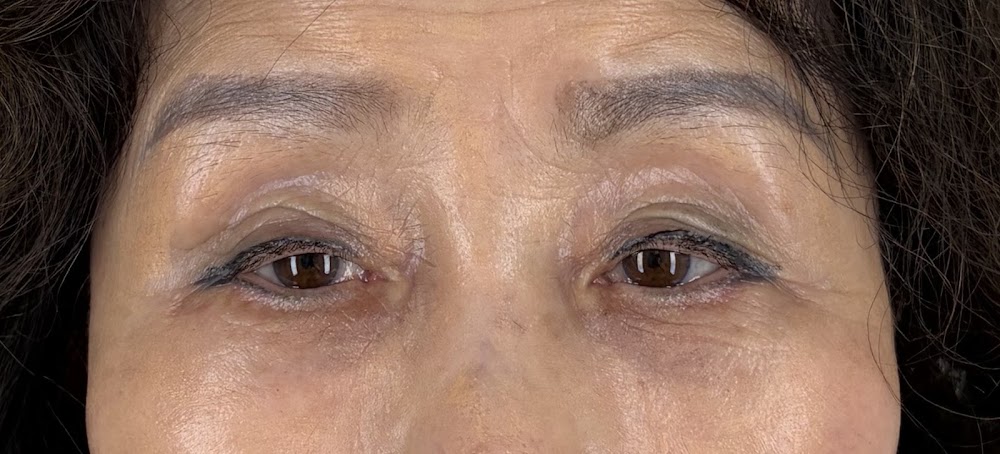 오호성형외과 l OHO Plastic Surgery l OHO整形外科 — clinic photo 3