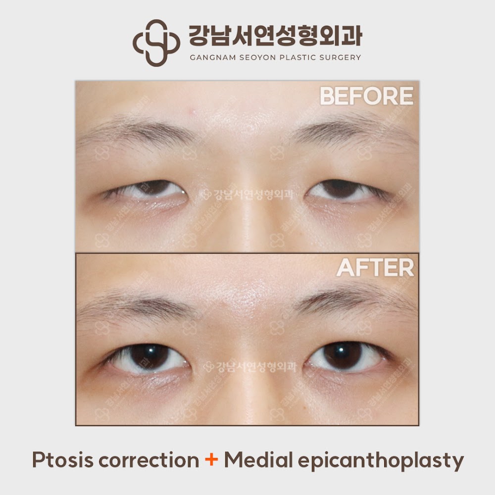 Gangnam Seoyon Plastic Surgery Clinic — clinic photo 3