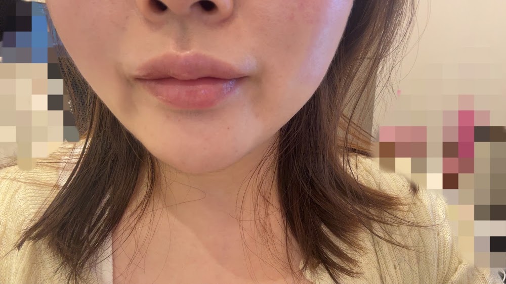 디유성형외과 DU plastic surgery — clinic photo 2