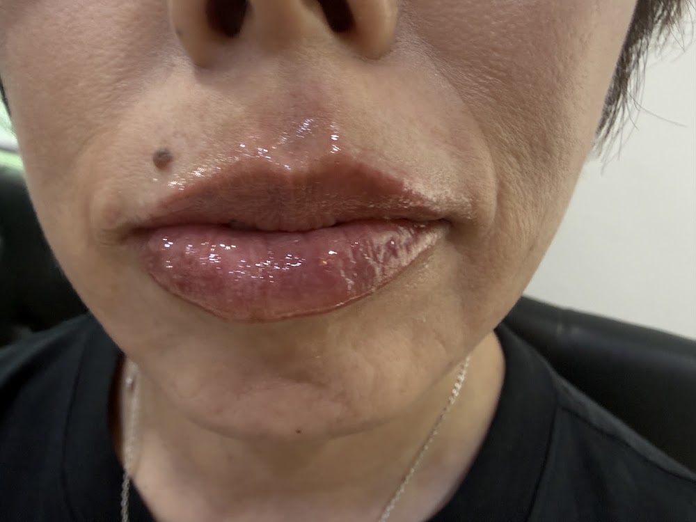 메이필클리닉| Meifill Clinic | メイフィールクリニック |美妼皮膚科（江南） — clinic photo 2