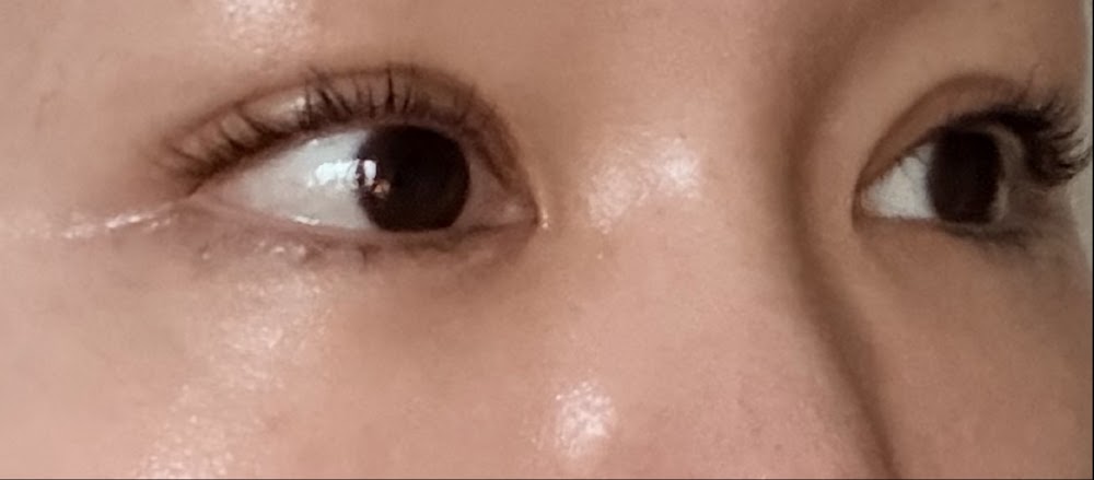Eye&Lifting plastic surgery clinic — clinic photo 3