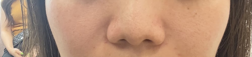 바이미성형외과의원 (BYME PLASTIC SURGERY, バイミ整形外科) clinic