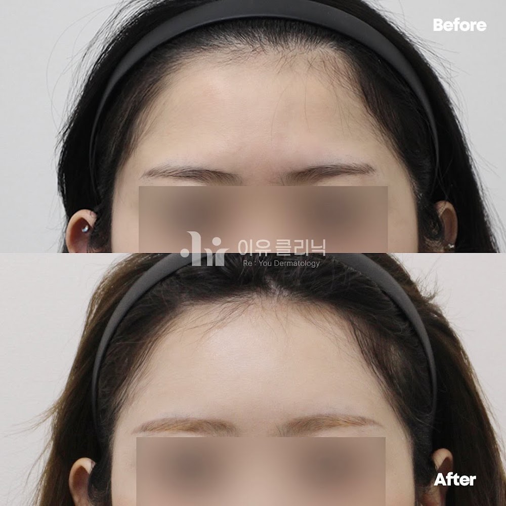 이유클리닉 l Re:You clinic l イユクリニック l 韓国皮膚科 — clinic photo 2