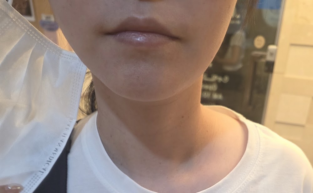 Apgujeong Miracle Clinic — clinic photo 3