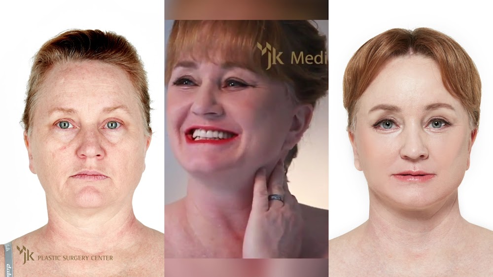 JK Plastic surgery clinic — clinic photo 3