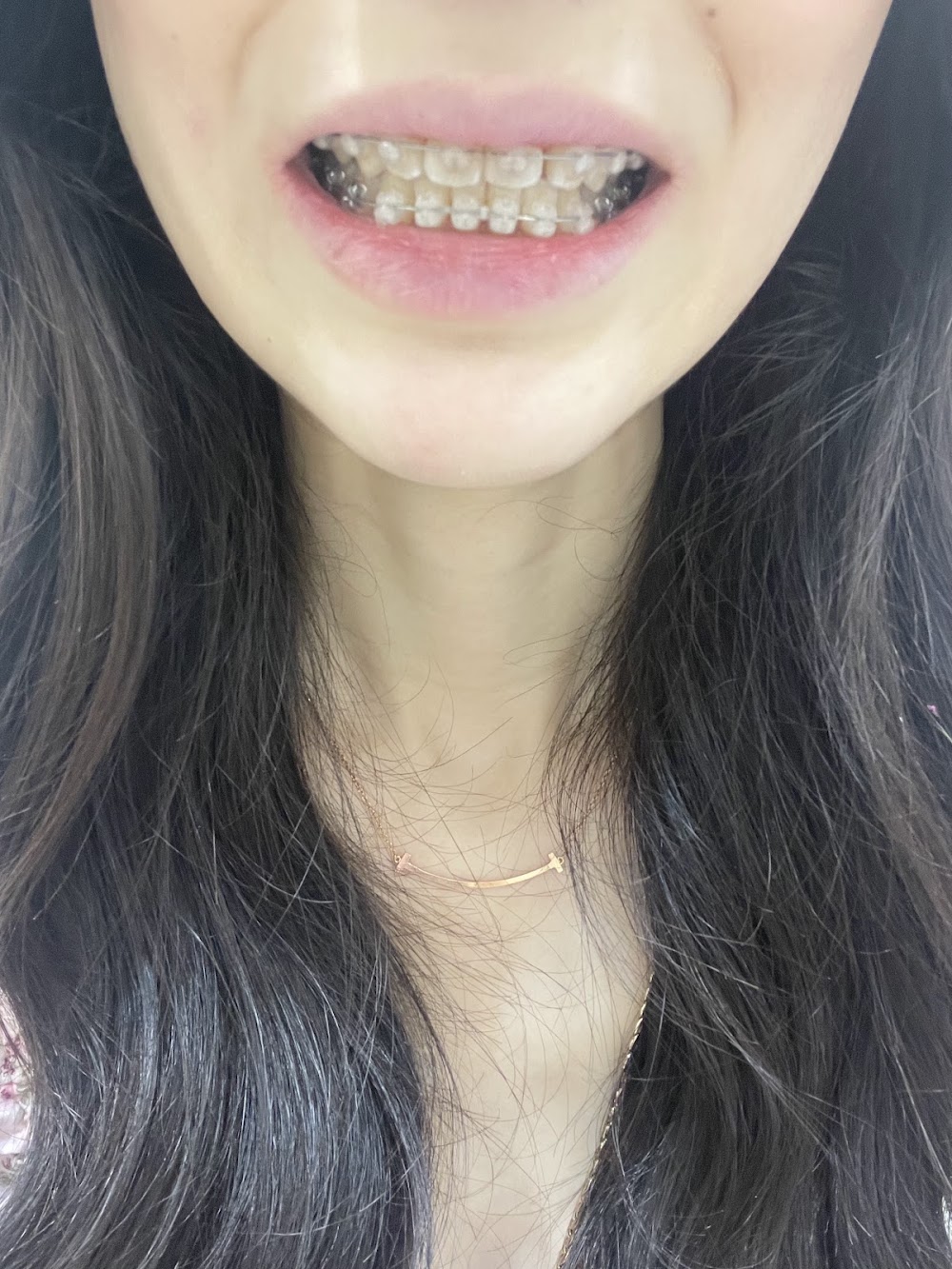 스마일디치과의원ㅣスマイル:D歯科ㅣSmile:D Dental ClinicㅣSmileD牙科医院 — clinic photo 3