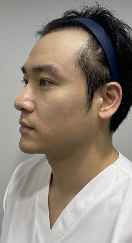 Cheongdam Okay Hair Transplant Center clinic