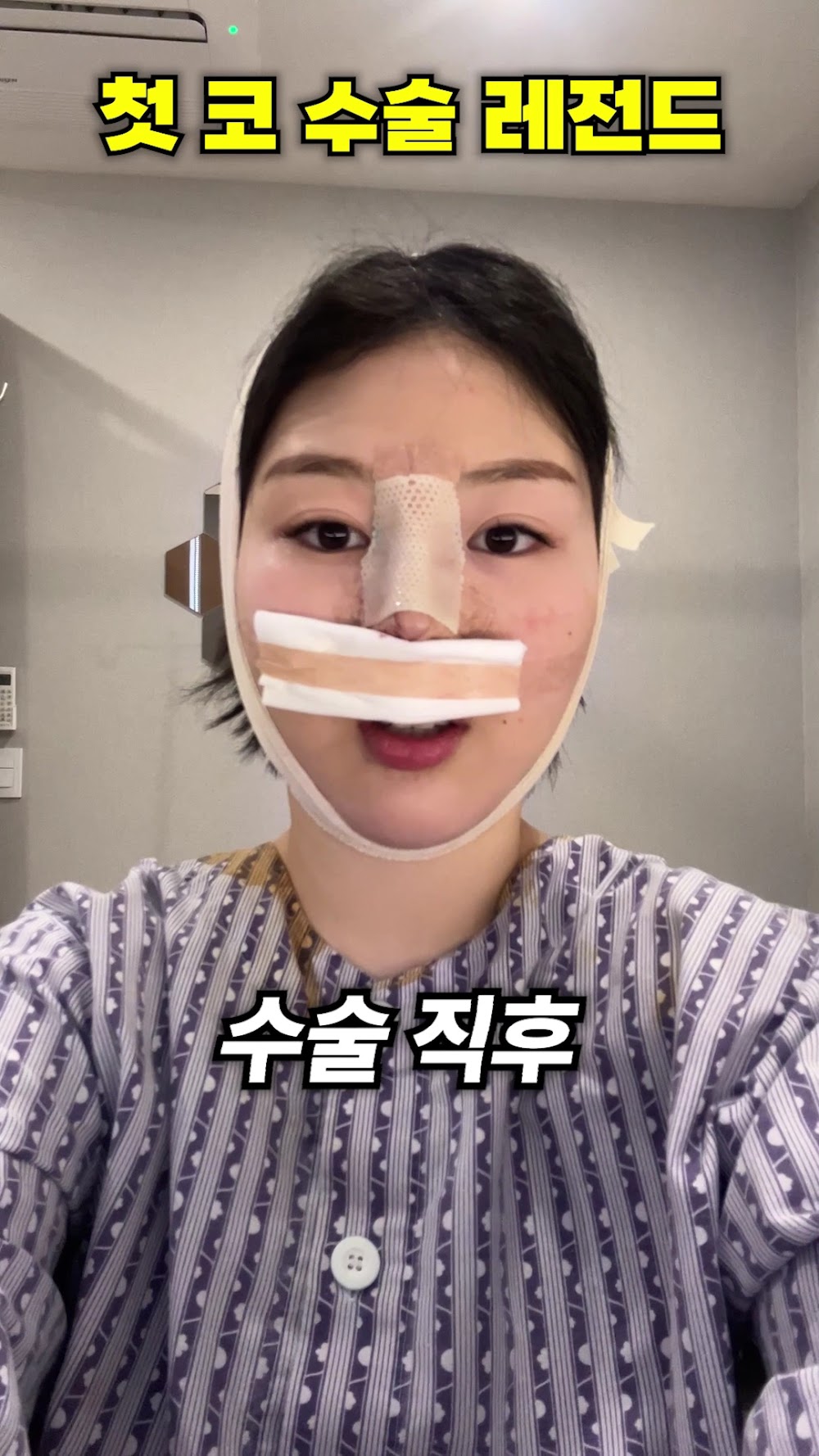 미자인의원 Mizain Plastic Surgery - Global Patient Services. Facial Plastic Surgery Specialist. — clinic photo 2