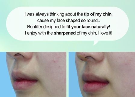 본연성형외과의원 | Bonyeon Plastic Surgery Clinic — clinic photo 2