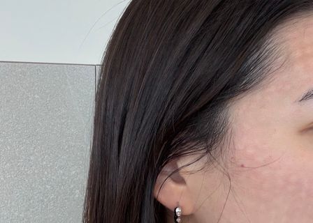 모찌의원 | MOCCI Clinic | 魔肌医院 | モチクリニック — clinic photo 1