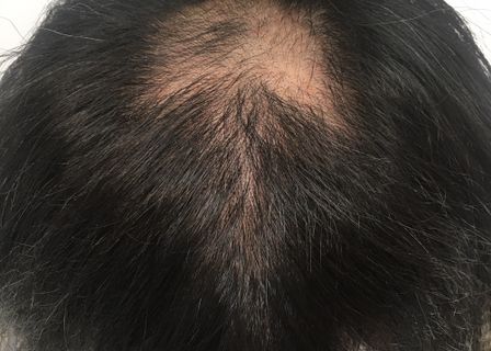 New Hair Institute — clinic photo 1