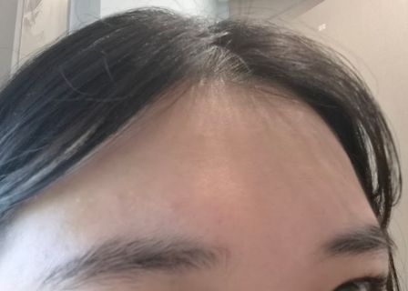 뷰티바성형외과 | Beautybar Plastic Surgery Clinic | 韓国美容 — clinic photo 1