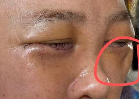 LARA Plastic Surgery (โรงพยาบาลศัลยกรรมลาร่า) 라라성형외과 — clinic photo 1