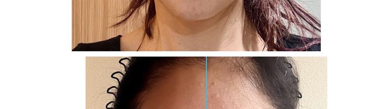 DASIPIUM Plastic Surgery clinic