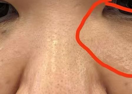 에이탑뷰티클리닉 | ATOP BEAUTY CLINIC | エートップビューティークリニック | 爱她皮肤科(ATOP皮肤科) | Seoul Gangnam Clinic | Ulthera Thermage Dermatology — clinic photo 1