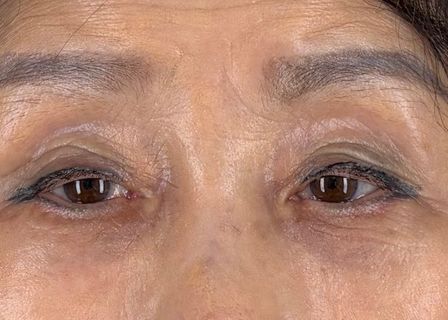 오호성형외과 l OHO Plastic Surgery l OHO整形外科 — clinic photo 3