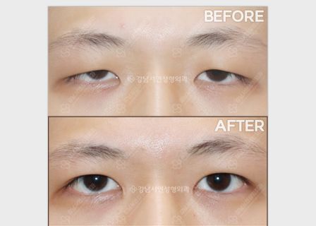 Gangnam Seoyon Plastic Surgery Clinic — clinic photo 3