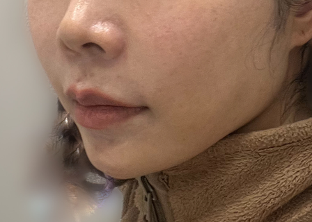 온도성형외과의원 ONDO plastic surgery — clinic photo 1