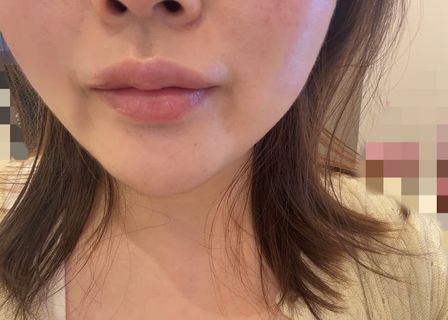 디유성형외과 DU plastic surgery — clinic photo 2