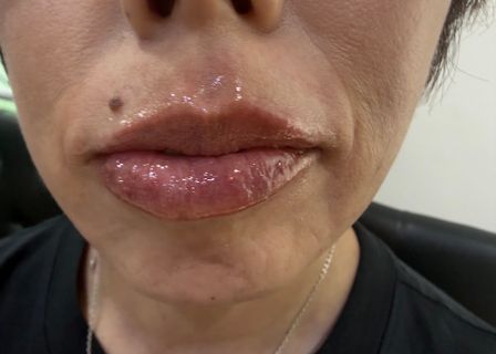 메이필클리닉| Meifill Clinic | メイフィールクリニック |美妼皮膚科（江南） — clinic photo 2