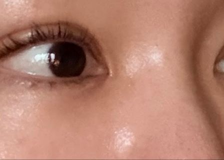 Eye&Lifting plastic surgery clinic — clinic photo 3