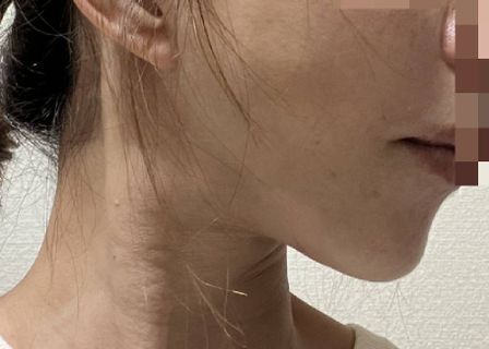 리프성형외과 LIFF PLASTIC SURGERY CLINICS — clinic photo 1