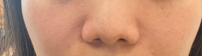 바이미성형외과의원 (BYME PLASTIC SURGERY, バイミ整形外科) clinic