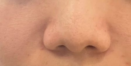 바이미성형외과의원 (BYME PLASTIC SURGERY, バイミ整形外科) — clinic photo 1