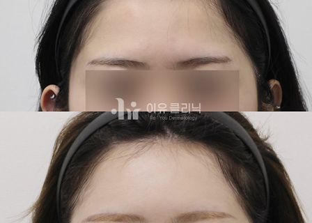 이유클리닉 l Re:You clinic l イユクリニック l 韓国皮膚科 — clinic photo 2