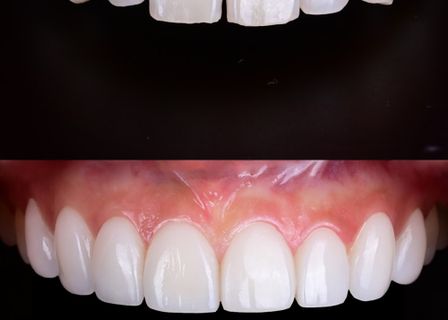 레브치과│Reve Dental Clinic│Reveレブ歯科│Reve瑞芙牙科 — clinic photo 1
