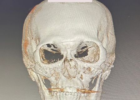 BN성형외과 — clinic photo 3