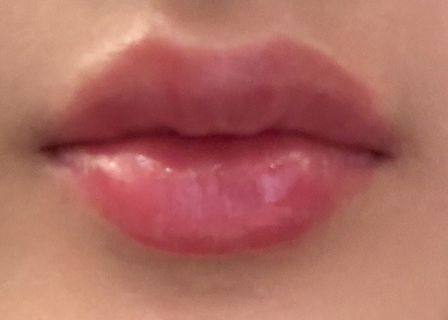 Littleprincess — clinic photo 1