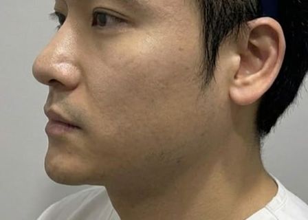 Cheongdam Okay Hair Transplant Center — clinic photo 1